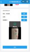 疤痕Helper
