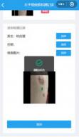 疤痕Helper